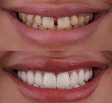 Cosmetic Dentistry